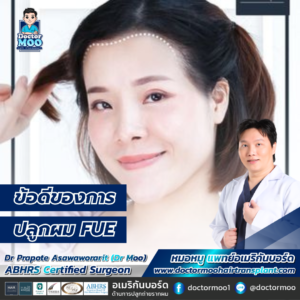 ข้อดีของการปลูกผม FUE