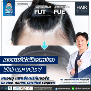 ความเข้าใจผิดระหว่าง DHI และ FUE