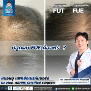 ปลูกผม FUE คืออะไร