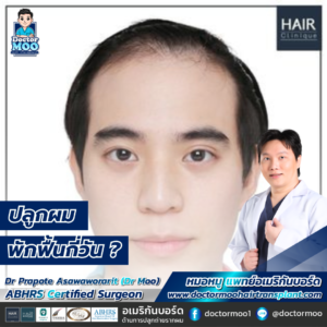 ปลูกผม พักฟื้นกี่วัน