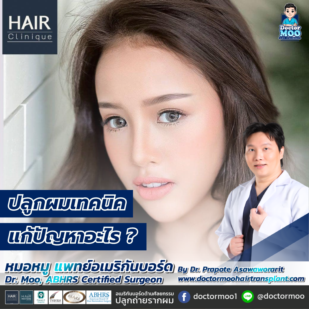 ปลูกผมเทคนิค FUE แก้ปัญหาอะไร