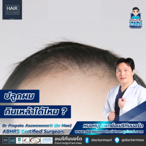 ปลูกผม กินเหล้าได้ไหม