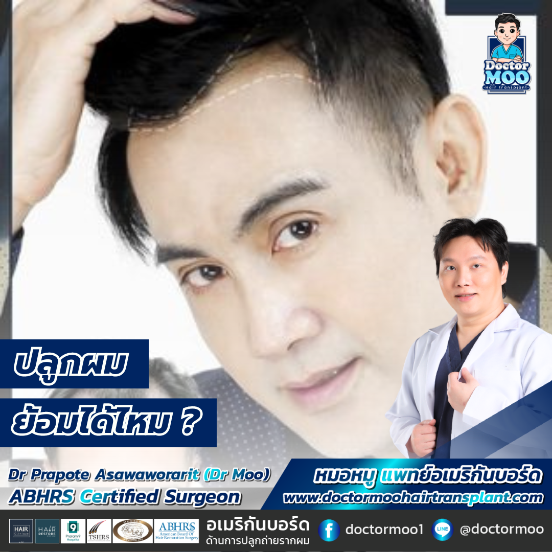 ปลูกผม ย้อมผมได้ไหม