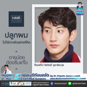 รีวิวปลูกผม หมอหมู