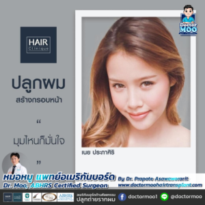 รีวิวปลูกผม หมอหมู