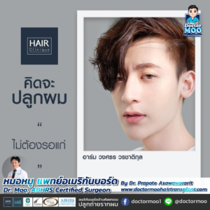 รีวิวปลูกผม หมอหมู