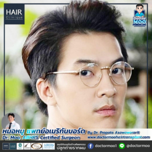 รีวิวปลูกผม หมอหมู