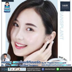 ปลูกผมผู้หญิง