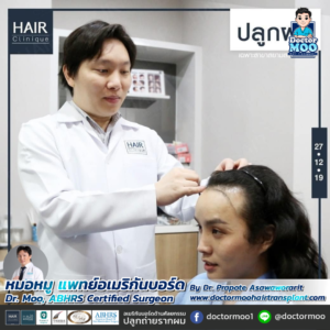 รีวิวปลูกผม หมอหมู