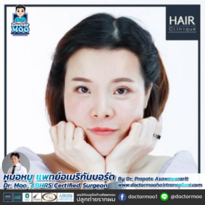 ปลูกผมผู้หญิง