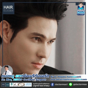 รีวิวปลูกผม หมอหมู