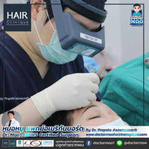 รีวิวปลูกผม หมอหมู