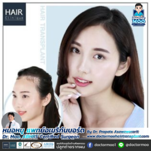ปลูกผมผู้หญิง