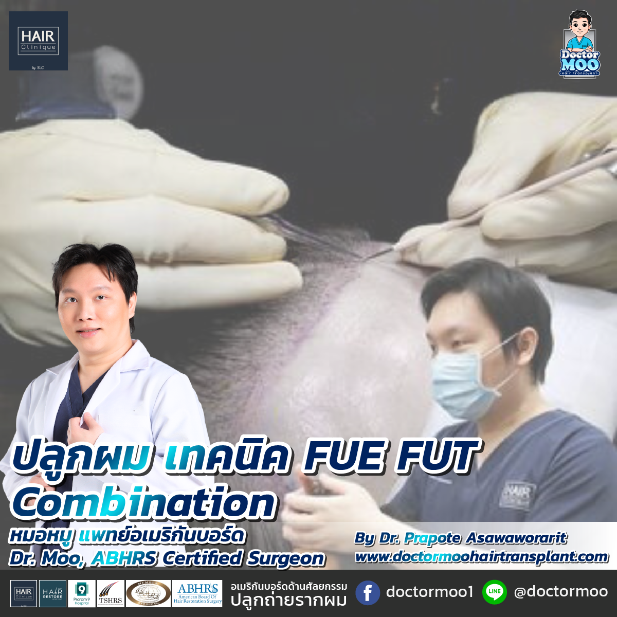 ปลูกผมเทคนิค FUE FUT