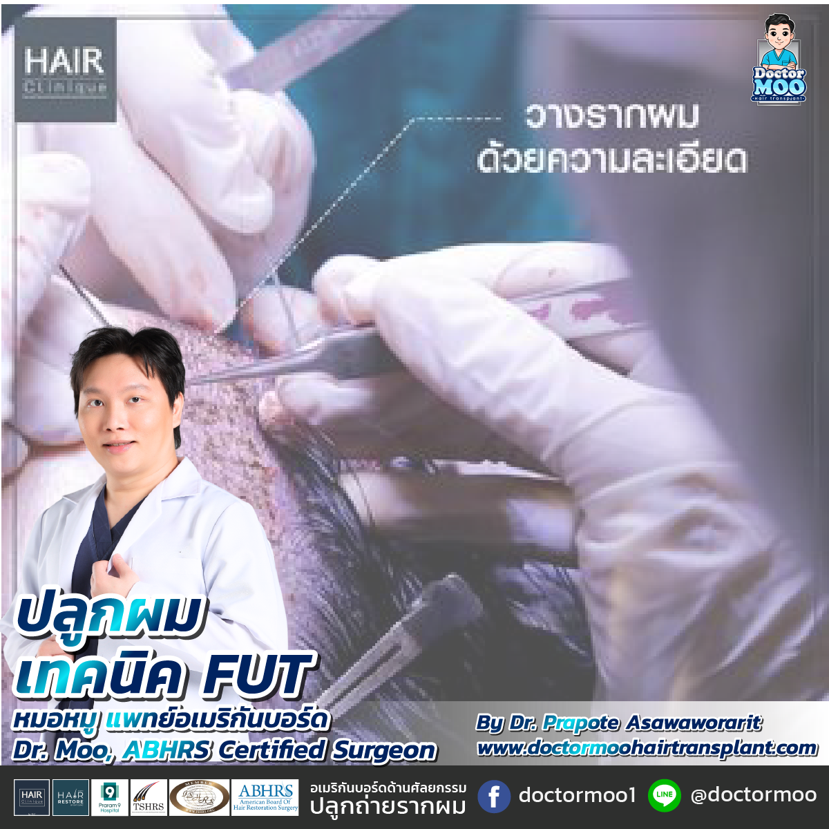 ปลูกผมเทคนิค FUT