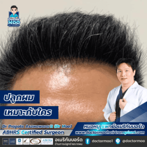 ปลูกผมเหมาะกับใคร