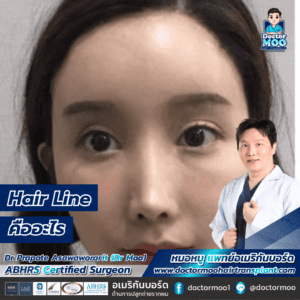 Hair Line คืออะไร