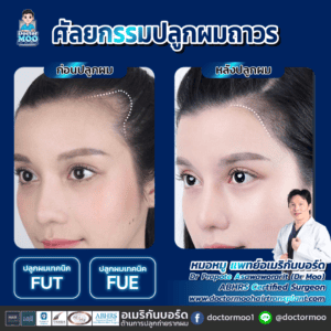 ปลูกผมผู้หญิง