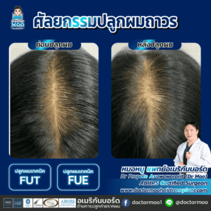 ปลูกผมผู้หญิง