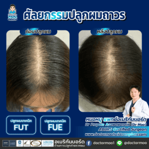 ปลูกผมผู้หญิง