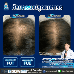 ปลูกผมผู้หญิง