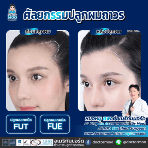 ปลูกผมผู้หญิง