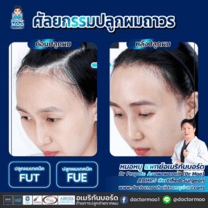 ปลูกผมผู้หญิง ผลข้างเคียง