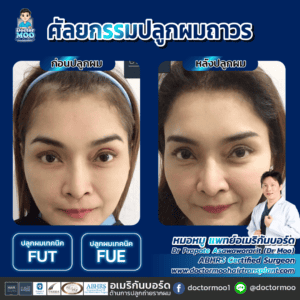 ปลูกผมผู้หญิง