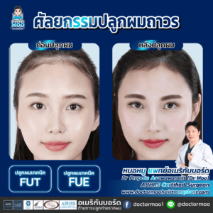 ปลูกผมผู้หญิง ผลข้างเคียง