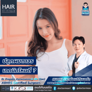 ปลูกผมถาวร เทคนิคไหนดี