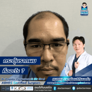 กระตุ้น รากผม