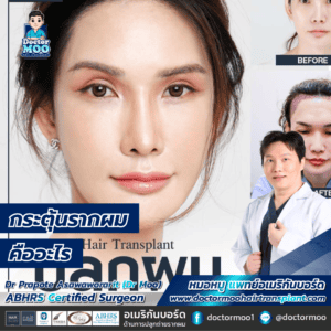 กระตุ้นรากผม คืออะไร