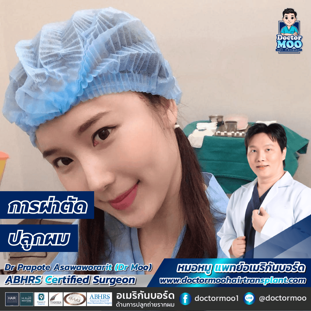 การผ่าตัดปลูกผม