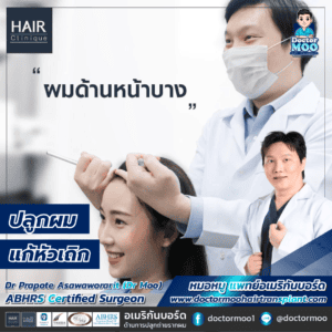 ปลูกผมแก้หัวเถิก