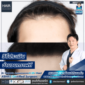 วิธีประเมินจำนวนกราฟท์