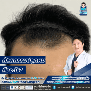 ศัลยกรรมปลูกผม คืออะไร