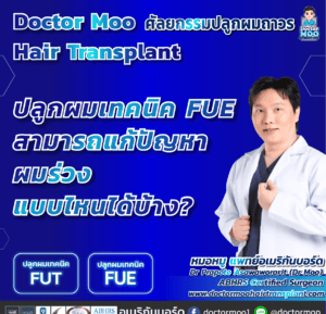 ปลูกผมเทคนิค FUE สามารถแก้ปัญหาผมร่วงแบบไหนได้บ้าง