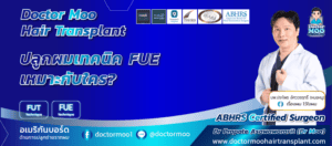 ปลูกผมเทคนิค FUE เหมาะกับใคร