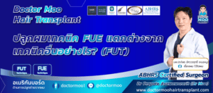 ปลูกผมเทคนิค FUE แตกต่างจากเทคนิคอื่นอย่างไร
