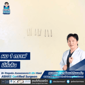 ผม 1 กราฟมีกี่เส้น