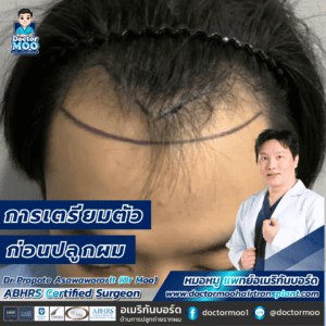 การเตรียมตัวก่อนปลูกผม