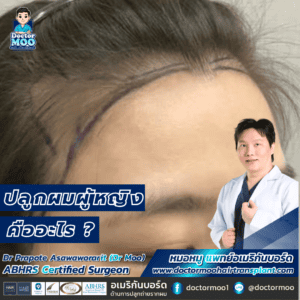 ปลูกผมผู้หญิง คืออะไร
