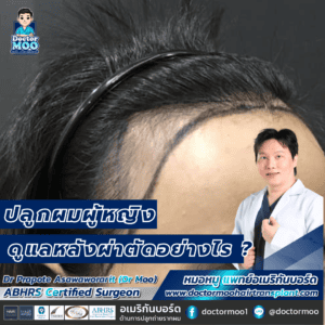 ปลูกผมผู้หญิง ดูแลหลังผ่าตัดอย่างไร