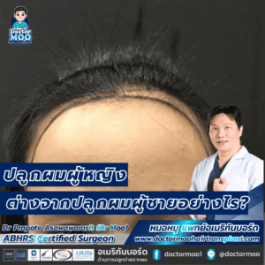 ปลูกผมผู้หญิง ต่างจากปลูกผมผู้ชายอย่างไร