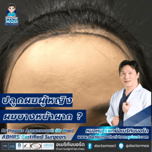 ปลูกผมผู้หญิง ผมบางหน้าผาก