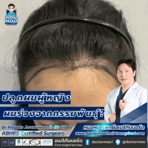 ปลูกผมผู้หญิง ผมร่วงจากกรรมพันธุ์