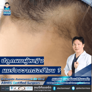 ปลูกผมผู้หญิง ผมร่วงจากฮอร์โมน