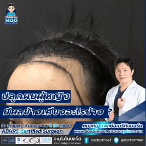 ปลูกผมผู้หญิง มีผลข้างเคียงอะไรบ้าง