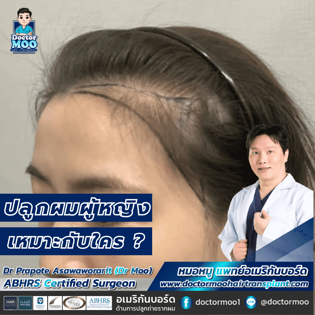 ปลูกผมผู้หญิง เหมาะกับใคร 