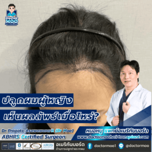 ปลูกผมผู้หญิง เห็นผลลัพธ์เมื่อไหร่